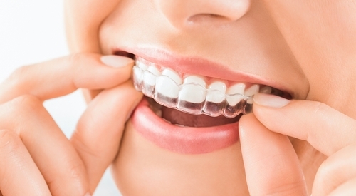 orthodontics-img2